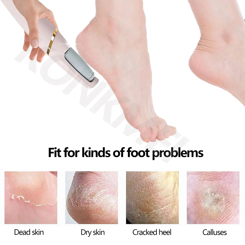 Eliminator - Electric Pedicure